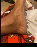 Feet beauty