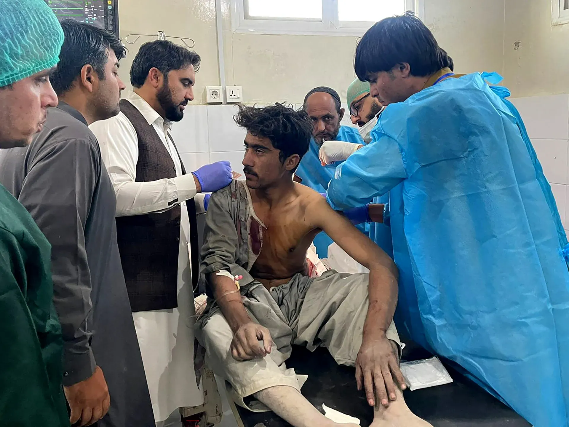 Dozens killed, injured in new Pakistan-Afghanistan border clashes